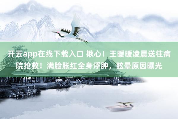 开云app在线下载入口 揪心!王暖暖凌晨送往病院抢救!满脸胀红全身浮肿,眩晕原因曝光